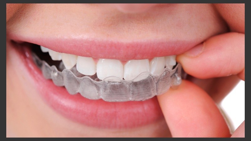Lo más habitual es utilizar una férula de descarga para proteger los dientes de la presión que se ejerce al apretar.