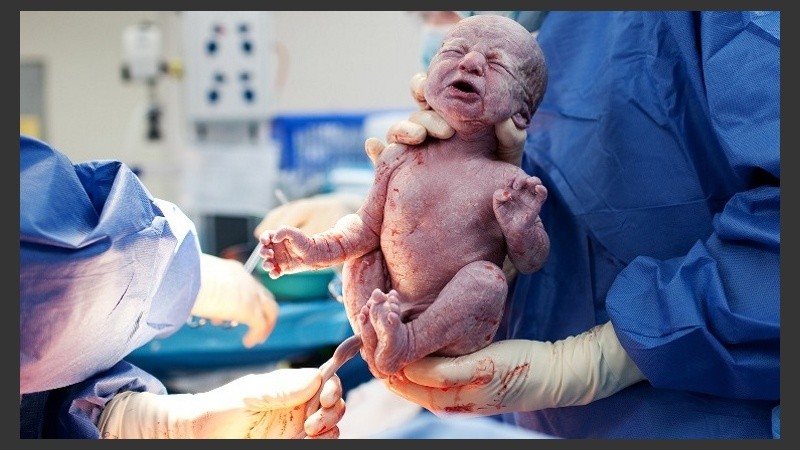 Los médicos sacaron un solo bebé del vientre de la mamá. 