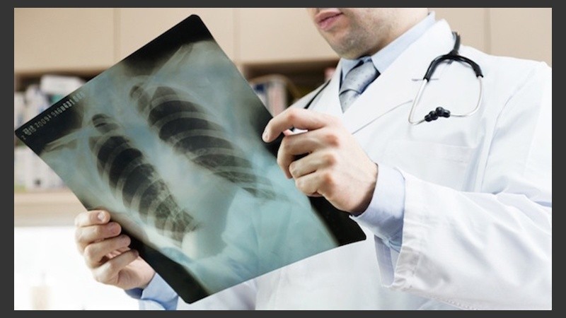 Entre un 10% y un 25% de los casos de cáncer de pulmón se observan en pacientes que nunca fumaron.