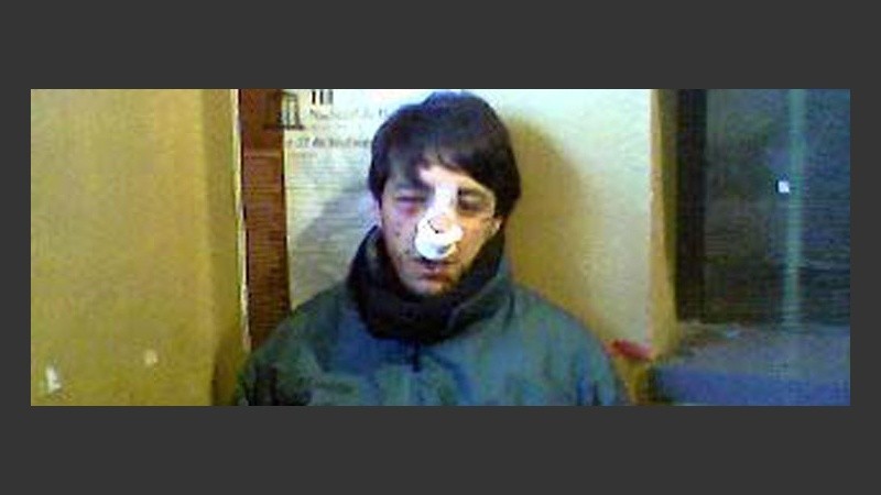 una interna radical dirimida a las piñas. 