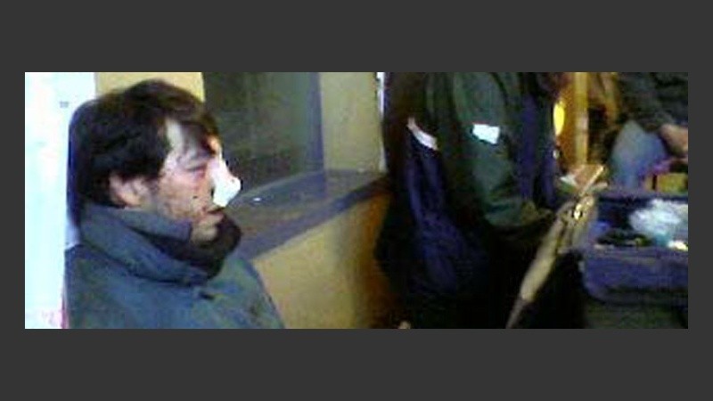 Después de la pelea, uno de los chicos debió ser hospitalizados.