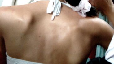 Les exigen ser cada vez más flacas.