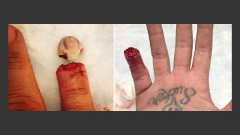 La imagen de la mano de James, en primer plano.