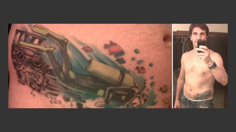 Un periodista que no esconde las marcas en su cuerpo.