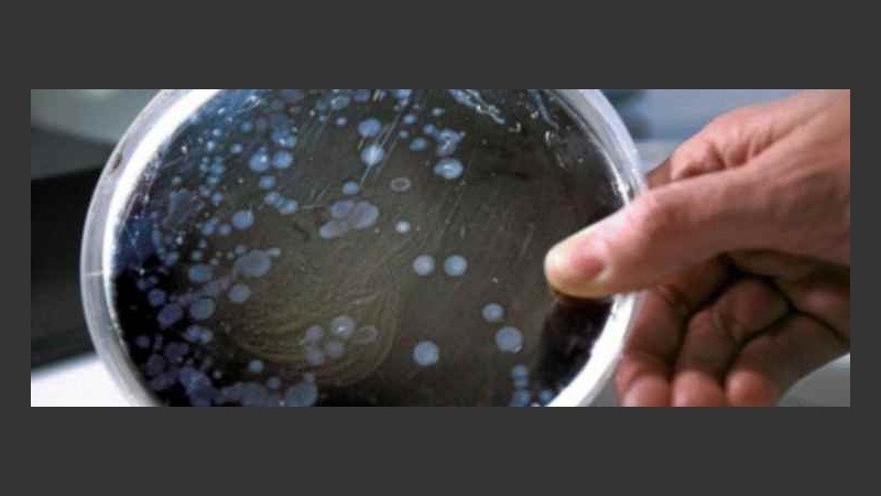 Sólo una de cada 33 mil personas contraen una infección de este tipo al año