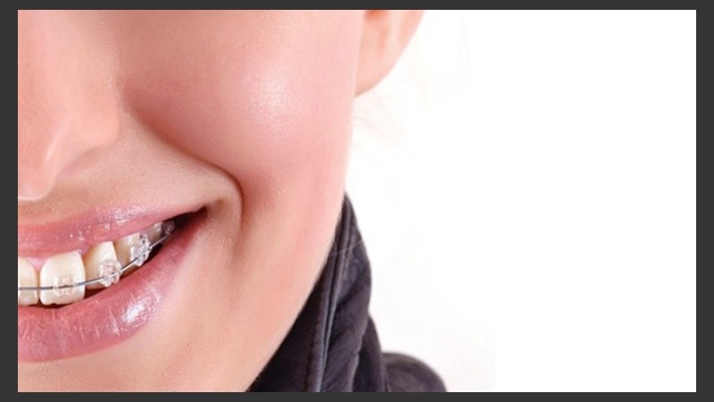 La ortodoncia en adultos es cada vez más frecuente.