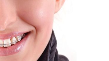 La ortodoncia en adultos es cada vez más frecuente.