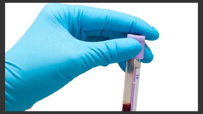 El SXF se puede diagnosticar mediante una prueba de ADN que se realiza en una muestra de sangre. 