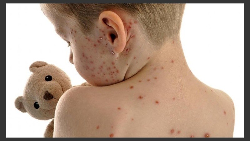 La mayoría tienen que ver con infecciones producidas por virus o bacterias.