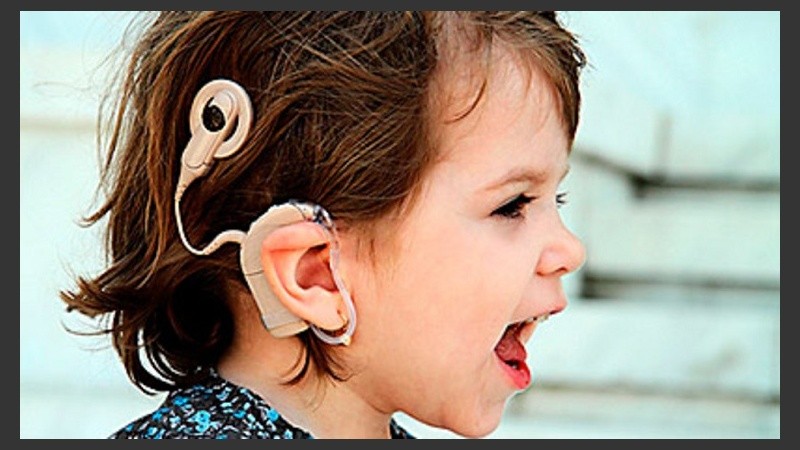 En marzo está previsto que el niño número 100 reciba su implante coclear.