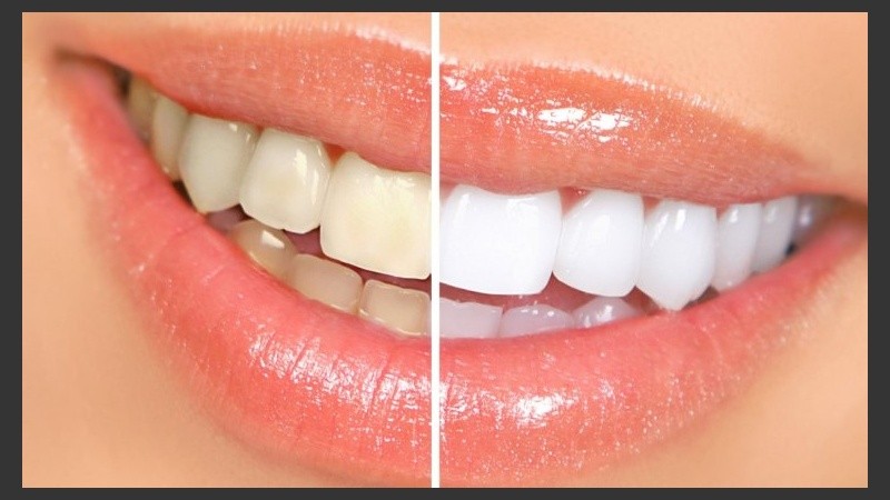 Se puede reducir los efectos de los alimentos sobre los dientes con un buen enjuague después de comer.