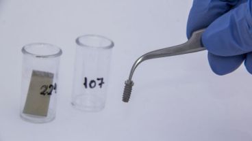 El equipo de investigadores desarrolla recubrimientos con alto contenido de fósforo y calcio para mejorar implantes quirúrgicos.