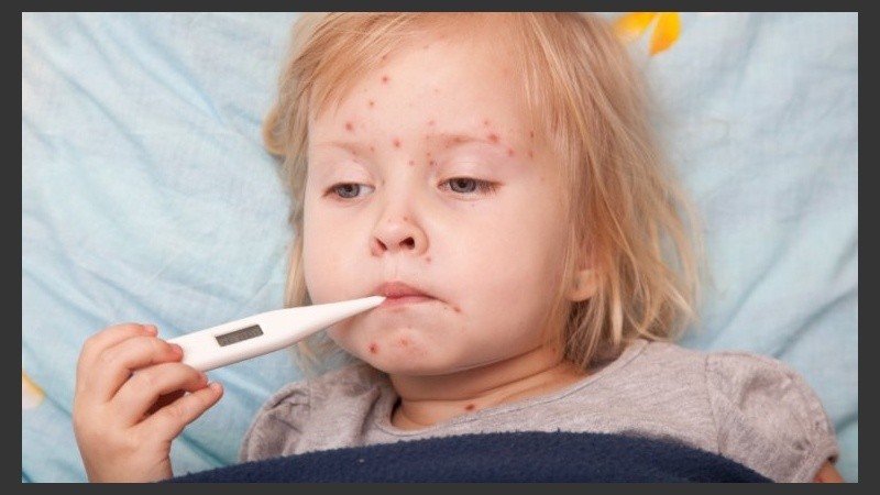 El motivo de esa amnesia inmunológica se debe a que el virus disminuye el número de linfocitos B y T, la infantería del sistema inmune.