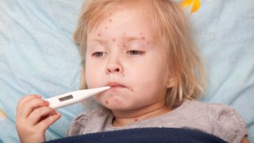 El motivo de esa amnesia inmunológica se debe a que el virus disminuye el número de linfocitos B y T, la infantería del sistema inmune.