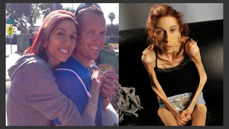 Farrokh recurrió a la plataforma de financiación colectiva GoFundme para alcanzar los 100 dólares necesarios para costear su tratamiento.