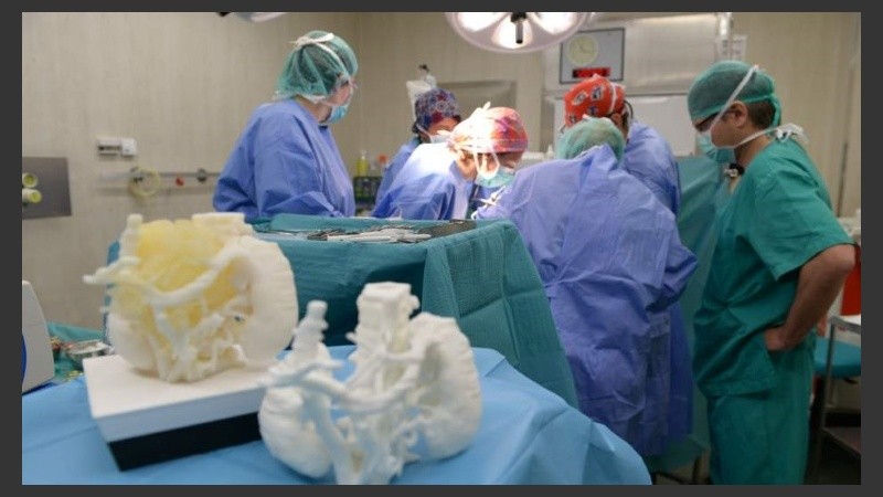 Las técnicas 3D se usan cada vez más en cirugías complejas a nivel mundial.
