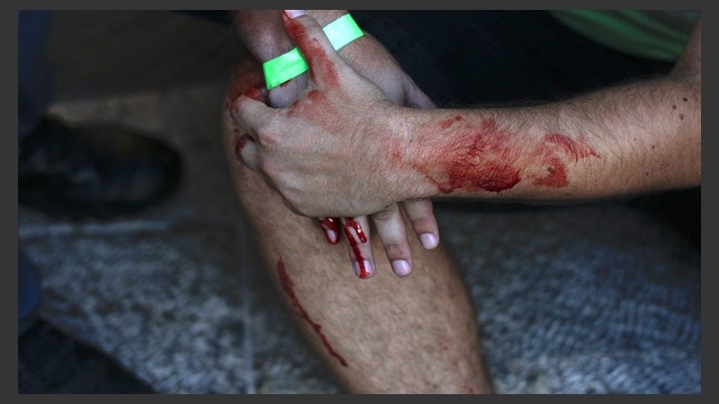 Las manos de sangre. En 2005 hubo un caso similar en Israel. (EFE)