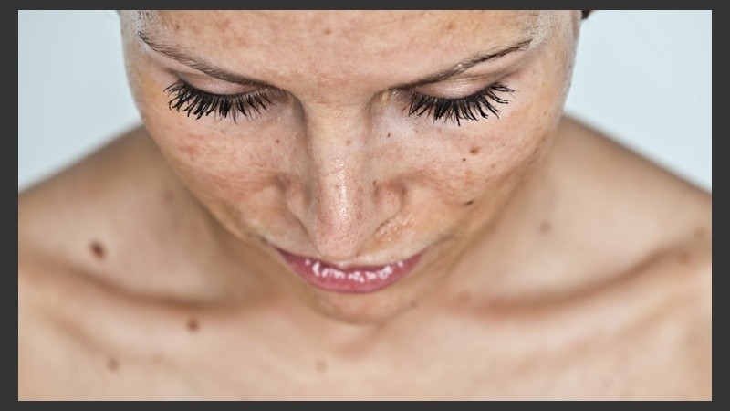 Las manchas en la piel son algo muy común en la piel de prácticamente todos los adultos.