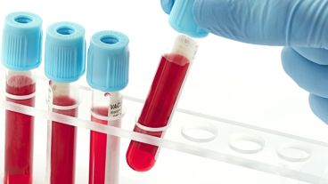 "El diagnóstico es muy sencillo y puede detectarse a través de un simple análisis de sangre".