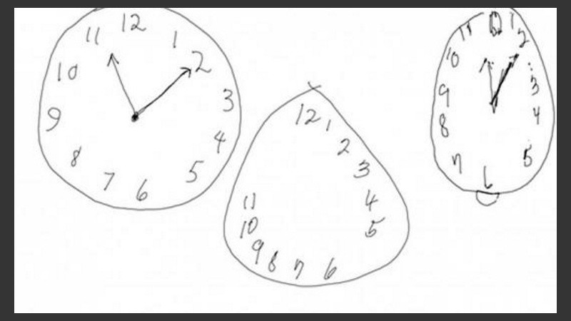 Los tres casos: un reloj dibujado por una persona sana, uno de una con Alzheimer y otro de una persona con mal de Parkinson.