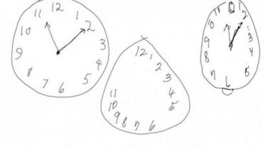 Los tres casos: un reloj dibujado por una persona sana, uno de una con Alzheimer y otro de una persona con mal de Parkinson.
