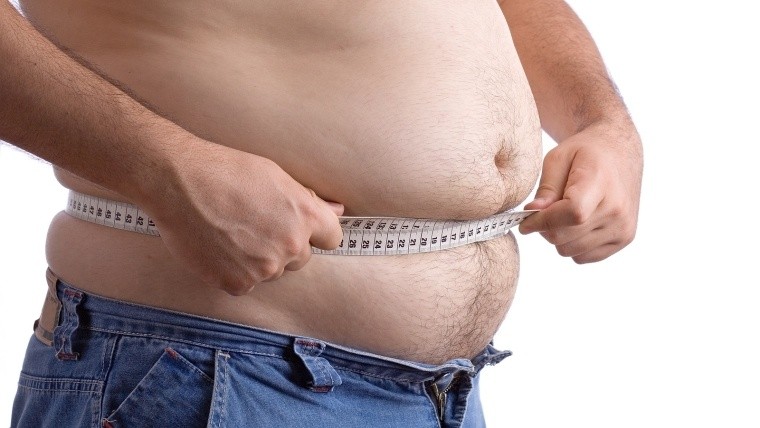 La leptina está asociada con la obesidad.
