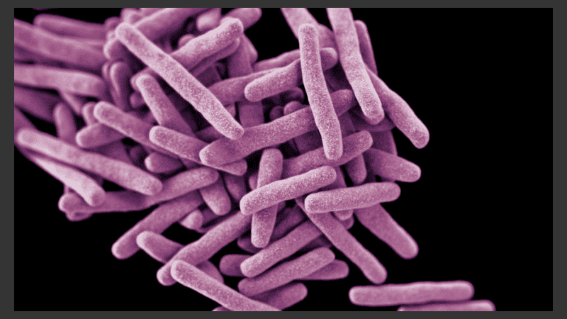 El organismo mundial busca que en 2050 la tuberculosis deje de ser un problema de salud pública.