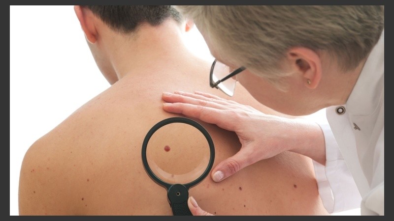 El 92 % de los pacientes logra resolver el cáncer de piel con este tipo de tratamiento no invasivo.