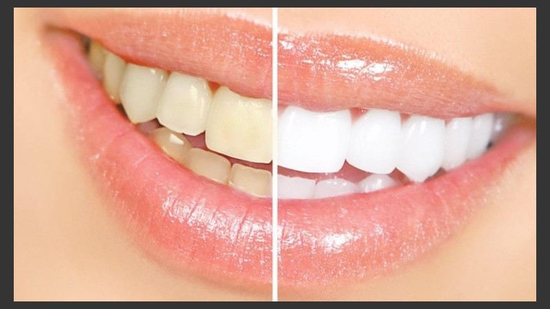 El paso del tiempo y el envejecimiento provocan que los dientes se manchen.