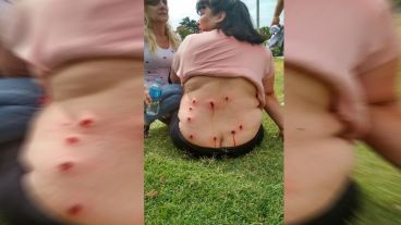 Una mujer herida de balas de goma