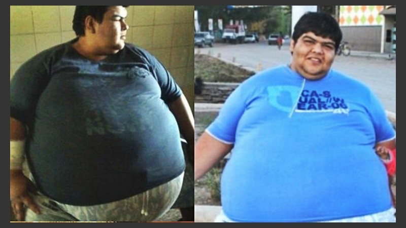En los últimos meses, Juan José pesaba 400 kilos, casi no se podía mover y le costaba mucho respirar, según se señaló.