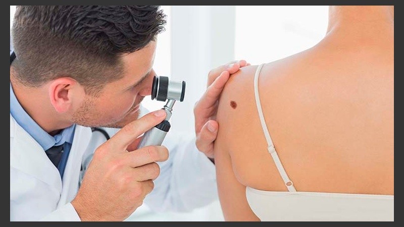 Cualquier lunar, llaga, protuberancia, imperfección, o cambio inusual en el aspecto o la sensación de un área de la piel podría ser una señal de melanoma.