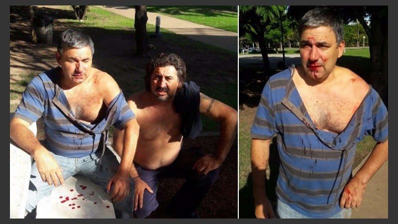 Así quedó el dirigente camionero después del ataque. 