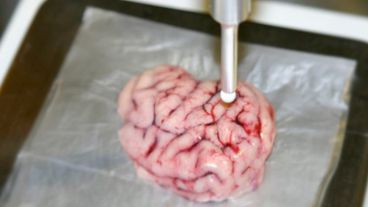 El prototipo fue probado en tumores artificiales y tejido cerebral porcino con excelentes resultados.