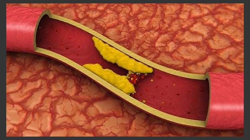La droga se suministró a pacientes con niveles de presión y colesterol borderline.