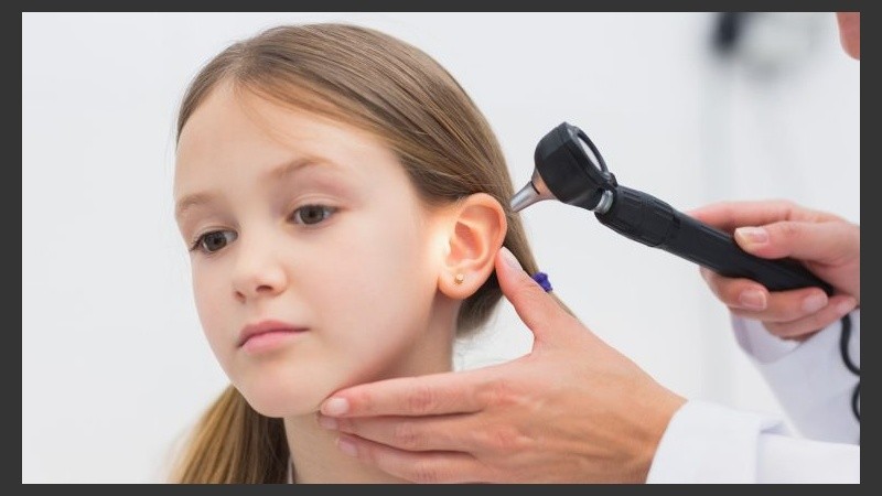 Un tercio de los niños pueden presentar otitis recurrentes con líquido en el oído medio.