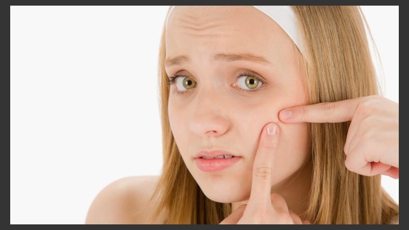 El acné tiene grandes consecuencias sobre el bienestar psicológico y la calidad de vida de quien lo padece.