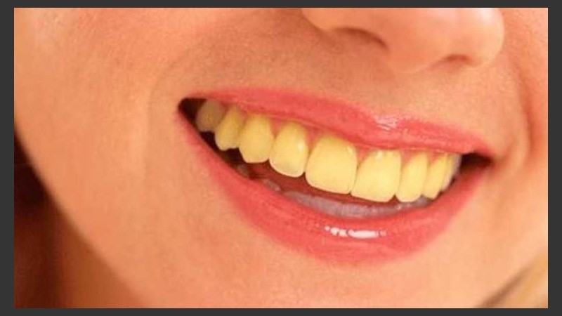 Los enjuagues bucales también son productos que pueden amarillear los dientes.