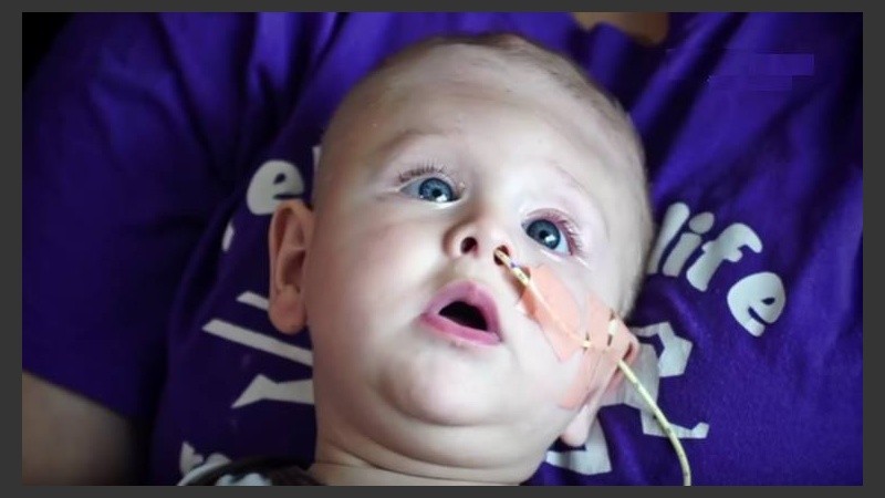 La encefaloce es una una dolencia que consiste en un divertículo del tejido cerebral y de las meninges que sale del cráneo.