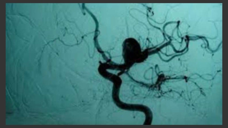 El proyecto está liderado por un investigador de Tandil y ya se probó en 60 pacientes.