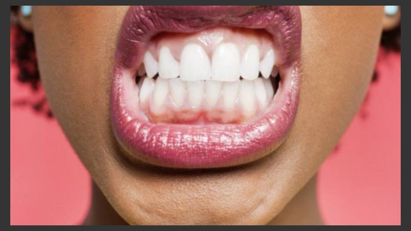 La blancorexia demanda un tratamiento psicológico y una atención 