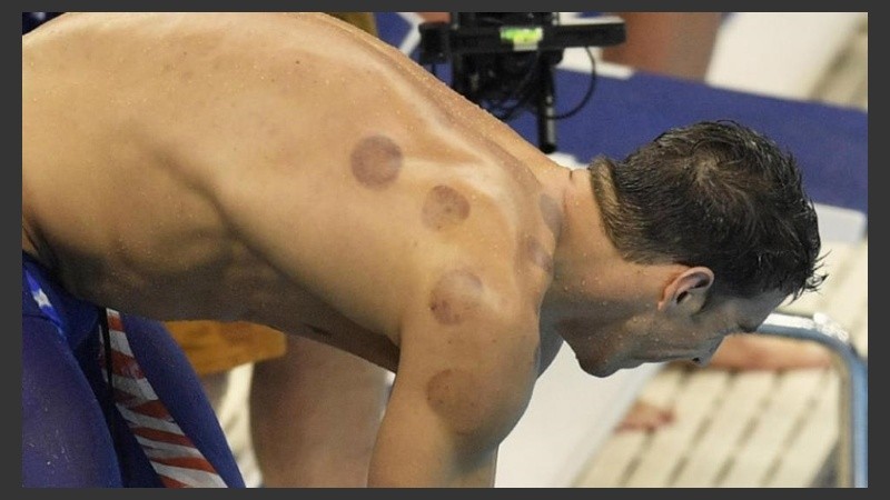 Las manchas pueden permanecer por semanas. 