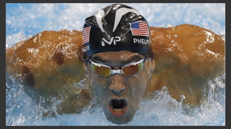 El cupping ayuda a mejorar el flujo sanguíneo a los músculos doloridos. 