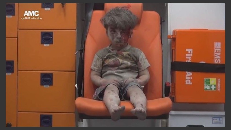 Omran Daqneesh, el niño de 5 años.