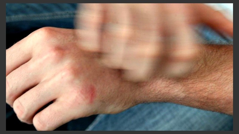 La ciencia logró desentrañar qué pasa en nuestro cuerpo y cerebro cuando nos rascamos.