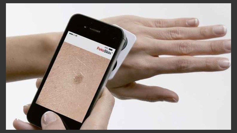 Gracias a las aplicaciones móviles y a la fotografía digital, se hace posible que el paciente pueda autoexplorarse con mayor facilidad.