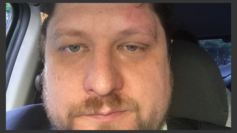 Las marcas de la agresión en el rostro del periodista.