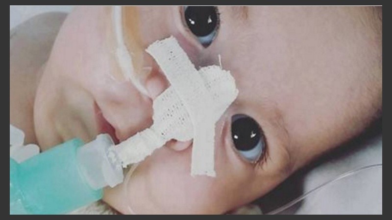 Aquiles tiene siete meses y está internado en el Hospital Español desde hace dos, a la espera de un tratamiento que le salve la vida.