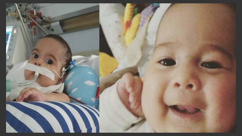 Aquiles tiene siete meses y está internado en el Hospital Español desde hace dos, a la espera de un tratamiento que le salve la vida.