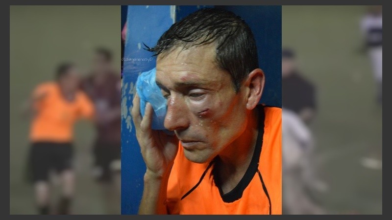 Así quedó el árbitro Claudio Elichiri tras sufrir los golpes de los hinchas de Sarmiento.
